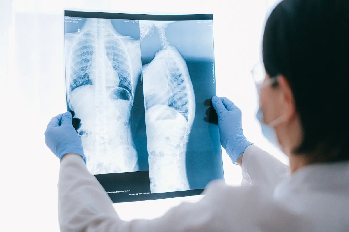 Orthopedic and Joint Replacement Surgery
